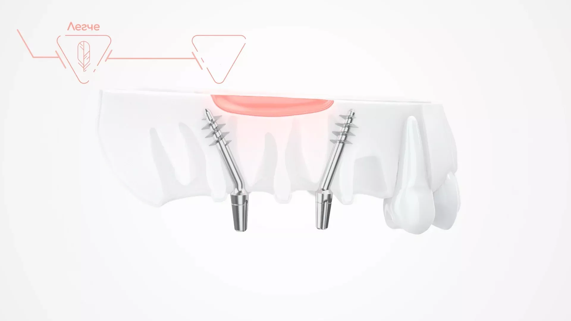L'animation 3D pour l'affiche de la clinique dentaire