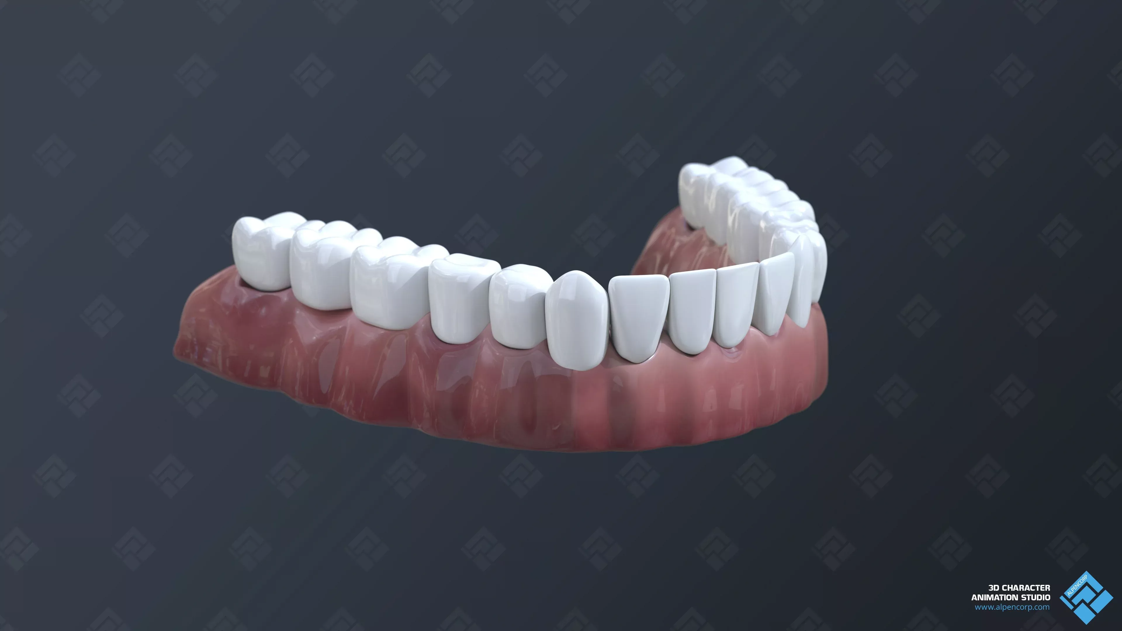 The temporary dental bridge's model.