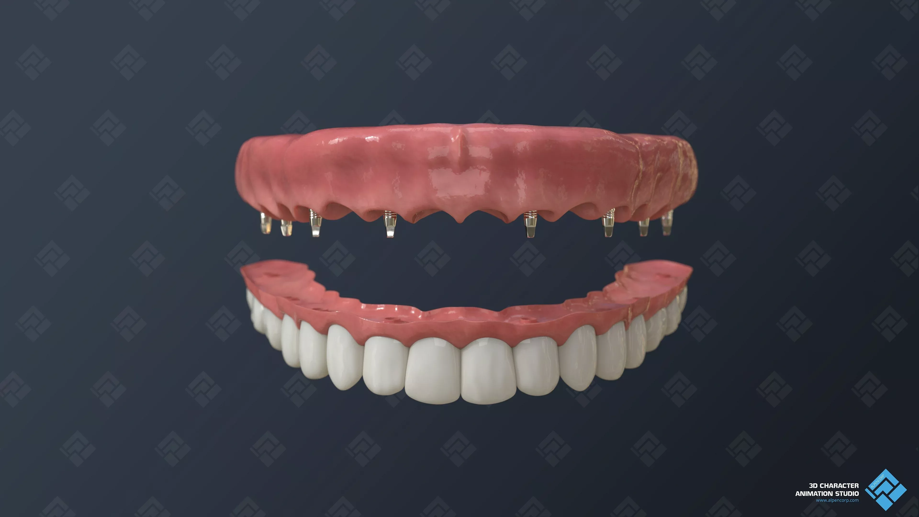 Die permanente Zahnbrücke für medizinische 3D-Videos.