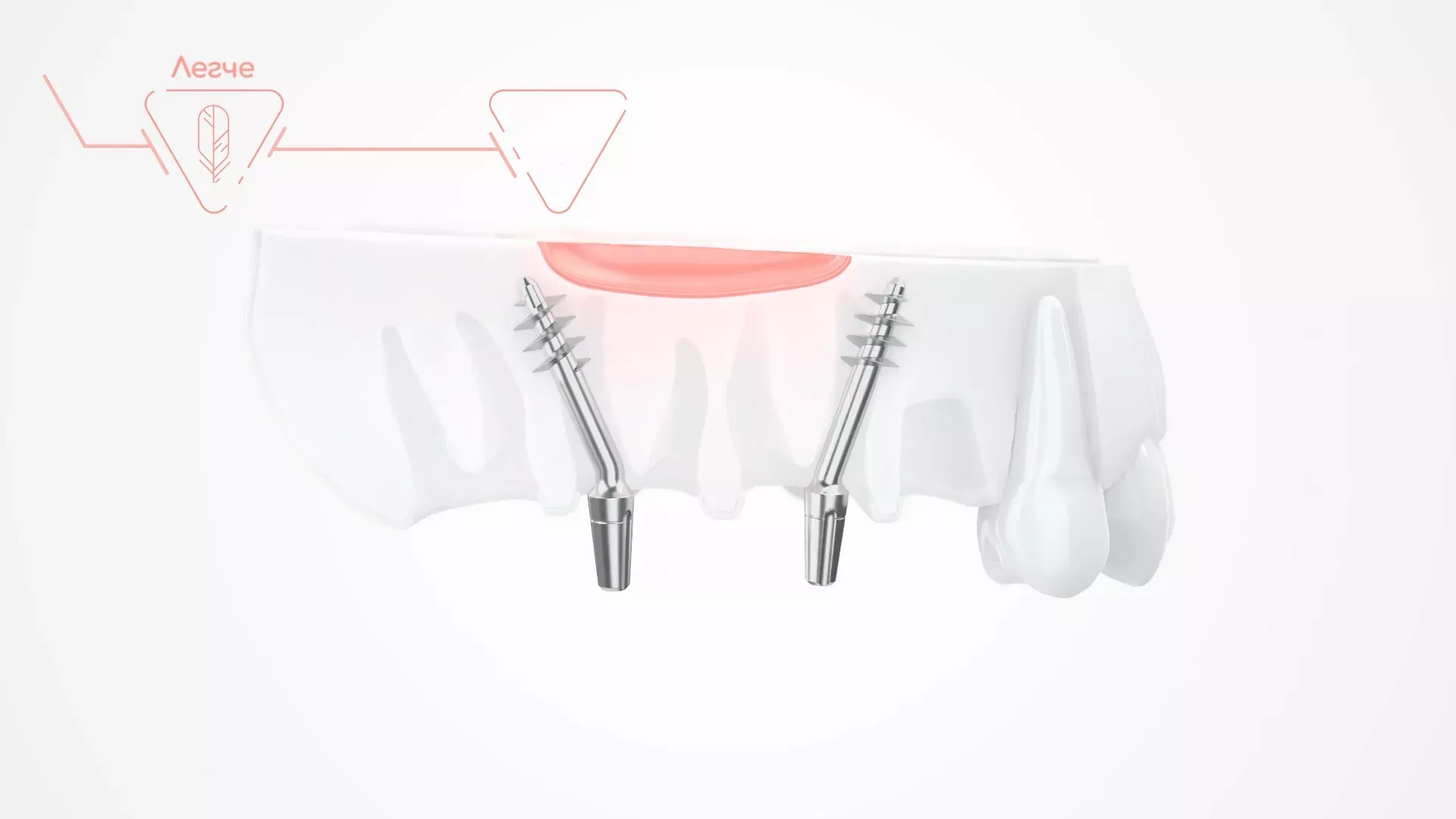 The 3D animation for the dental clinic poster