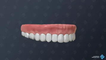 The temporal dental bridge for medical 3D video.