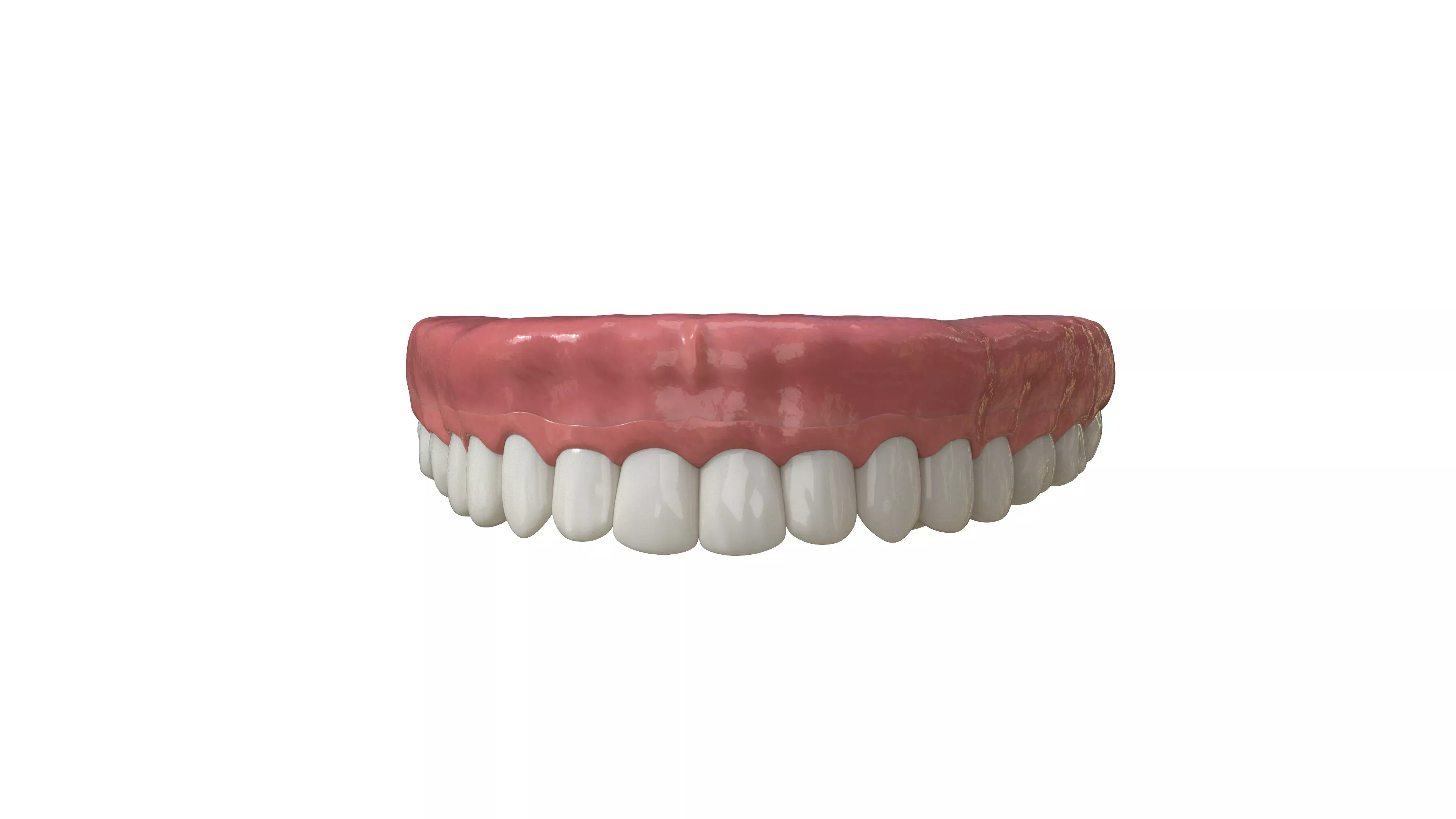 Die permanente Zahnbrücke für die medizinische 3D-Animation vor dem Compositing.