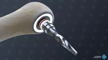 Close-Up View of the Drill for 3D Medical Animation.