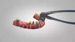 3D-Zahnarztanimation
