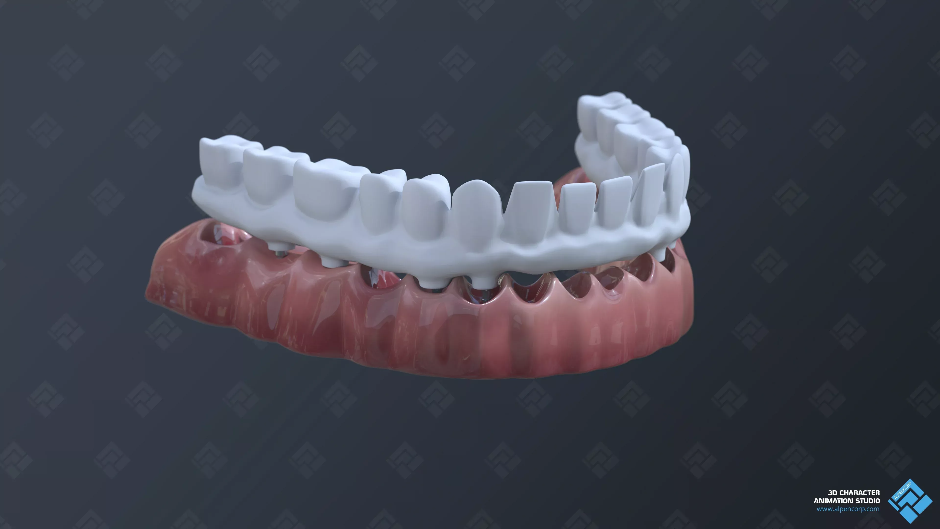 The dental bridge's frame model.